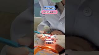 ลูกน้อยวัย 1 ขวบ ควรแปรงฟันให้ลูกอย่างไร?