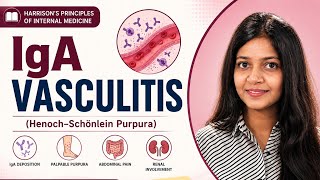 IgA Vasculitis ( HSP ) 