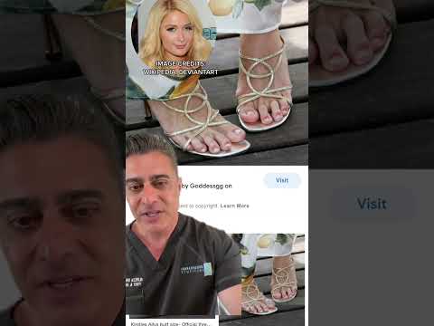 Paris Hilton's Foot Problems 🚫