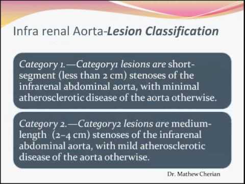Aorto Iliac Disease - Part 1
