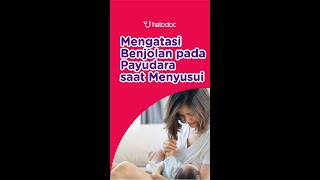 Download lagu Treat breast lumps while breastfeeding with these 5 ways. #shorts mp3 Download lagu Treat breast lumps while breastfeeding with these 5 ways. #shorts mp3