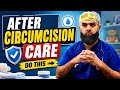 Circumcision Care How To CARE After CIRCUMCISION