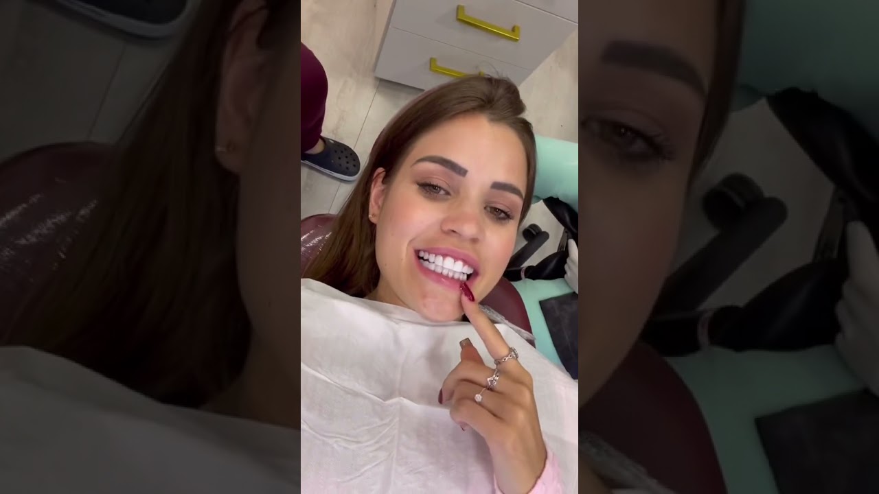 TIREI AS LENTES DE CONTATO DO DENTE *ficou horrível*