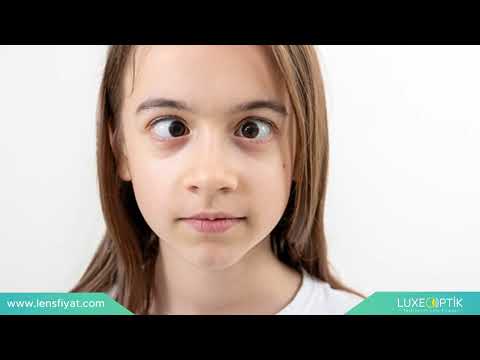 Diplopi Nedir? Gözlerinizde Çift Görme Hakkında Bilgilendirme | Lens Tv