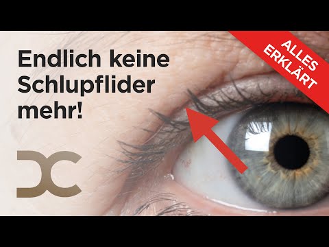 Oberlidstraffung: Die OP für ein natürliches Ergebnis - Schlupflider straffen