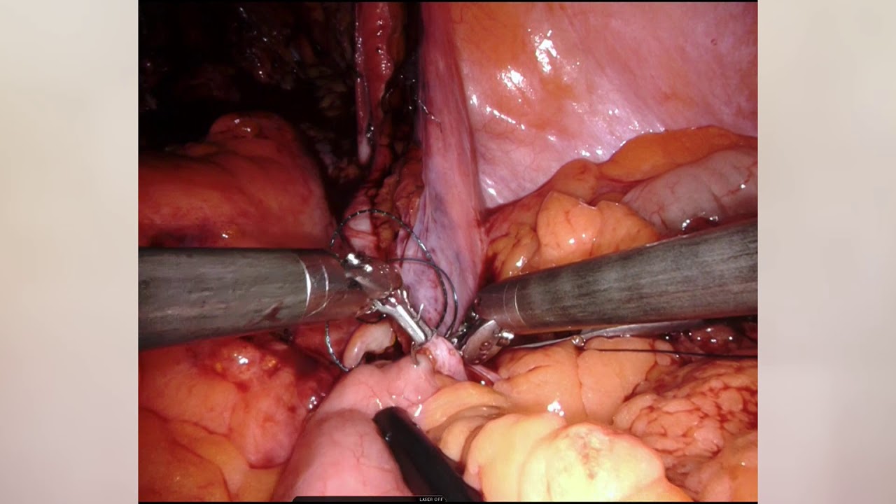 José Ignacio Pérez Reggeti-2