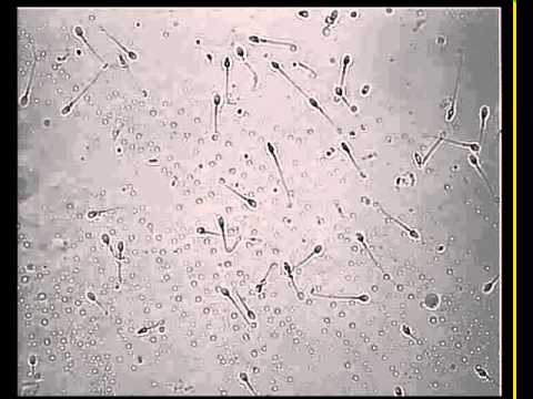 Sperm Videos Recorded Through V-Sperm on the SQA-V Automated Semen Analyzer