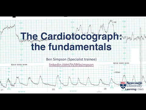 CTG fundamentals part 2