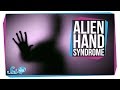 Alien Hand Syndrome When A Limb Goes Rogue