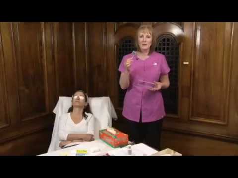 Micro needling by Tracy