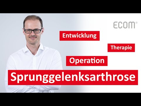 Sprunggelenksarthrose - Drei wichtige Antworten vom Spezialisten