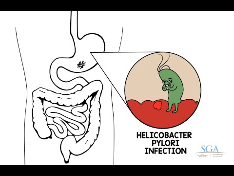 helicobacter pylori paraziták a mitol orrszarvú