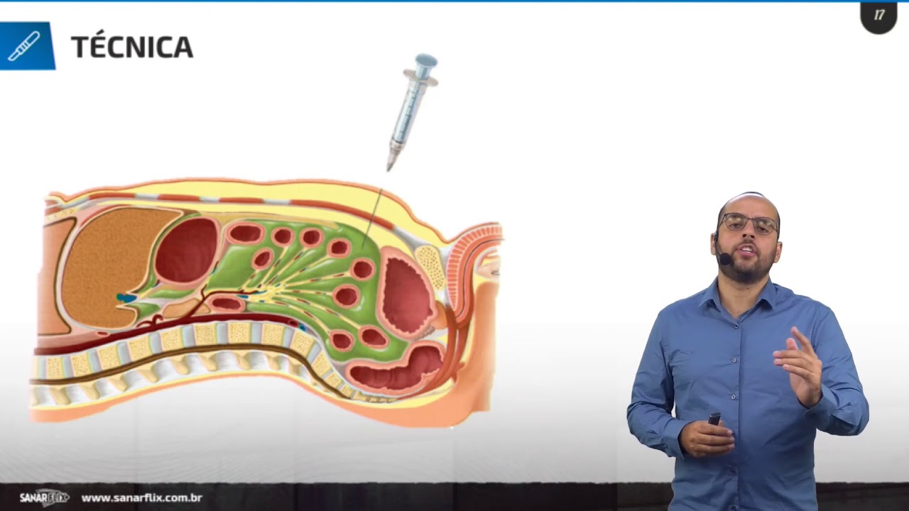 Paracentese - Aula de Procedimentos SanarFlix