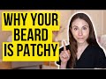 Why You Have A Patchy Beard