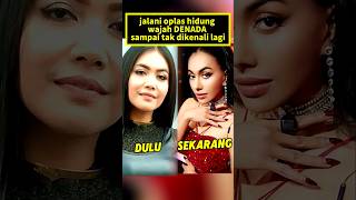 Download lagu After plastic surgery, DENADA's face changed drastically. mp3