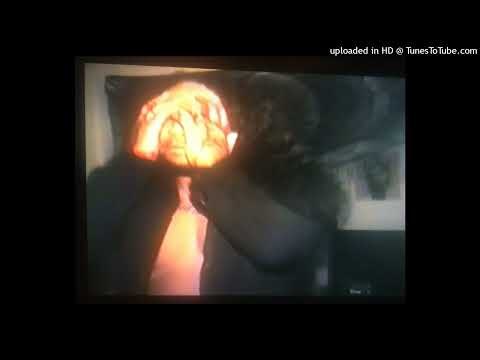 Teezus Christ - VORTEX (prod @orcmusic)