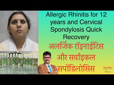 Allergic Rhinitis for 12 years and Cervical Spondylosis Quick Recovery Dr.Ravi Singh