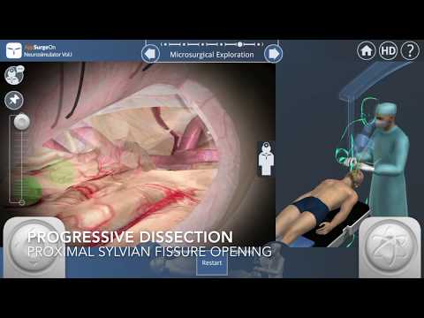 Neurosimulator Vol.I Video