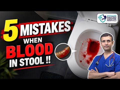Blood in Stool: When It's Harmless vs When It's Serious (Doctor Explains)