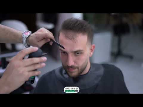 From Bald to Beautiful, Transforming Thinning Hair to Fullness with THICK FIBER