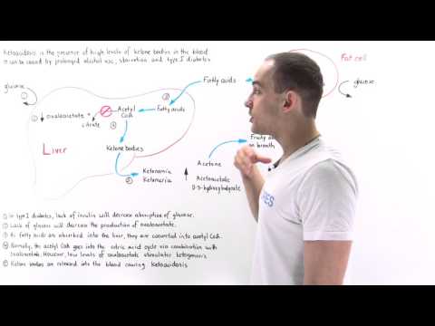 Diabetic Ketoacidosis