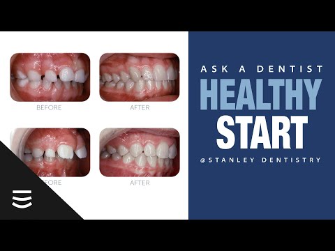 Ask a Dentist: Healthy Start