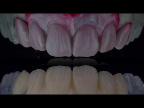 Amber LiSi  POZ 6 unit