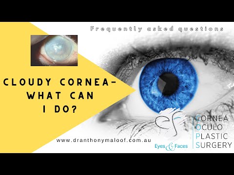 FAQ - Cloudy cornea - What can I do - Dr Anthony Maloof, Sydney