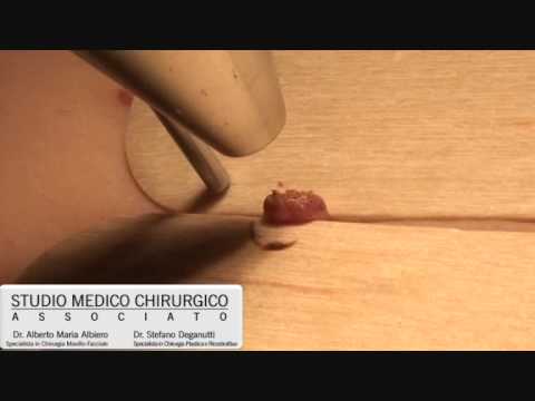 Esame RM del ginocchio Di tazza utile con il ginocchio