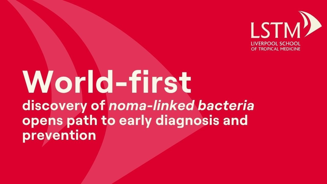 World-first discovery of noma-linked bacteria opens path to early diagnosis and prevention | LSTM