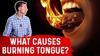The Causes & Treatment of Burning Tongue (Mouth) – Dr. Berg