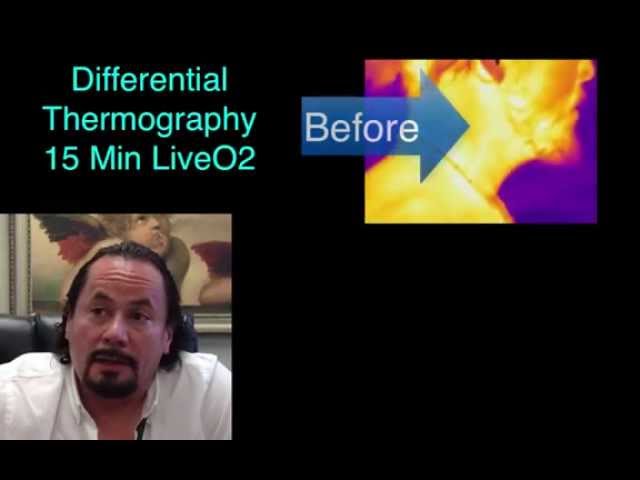 LiveO2 vs Hyperbaric Oxygen Therapy