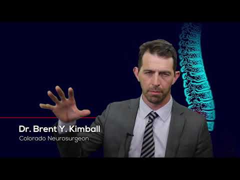 Do You Need A Spinal Fusion?