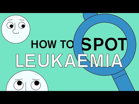Leukaemia: what is it, how to spot the warning signs and who is at risk?