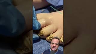 Download lagu DOCTOR REACTS: ARE THESE TOENAILS DEAD? 😱 #shorts mp3 Download lagu DOCTOR REACTS: ARE THESE TOENAILS DEAD? 😱 #shorts mp3