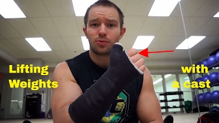 How to workout with an arm cast | Exercises and mental focus