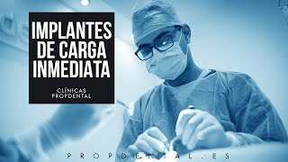 Cirugía de la colocación de implantes carga inmediata