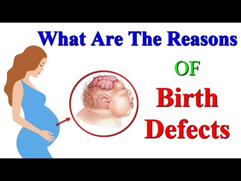How To Prevent Birth Defects | Reasons Of Birth Defects | Pregnancy Care Tips