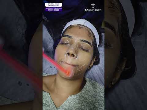 ✨ Crystal clear skin lighting glowing skin starts here ✨