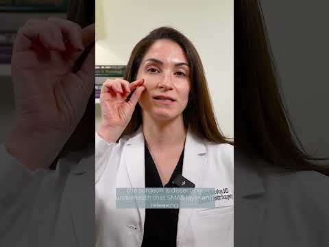 SMAS vs Deep Plane Facelift