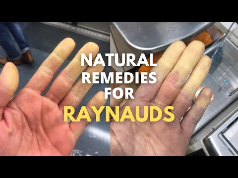 5 natural remedies for RAYNAUD'S