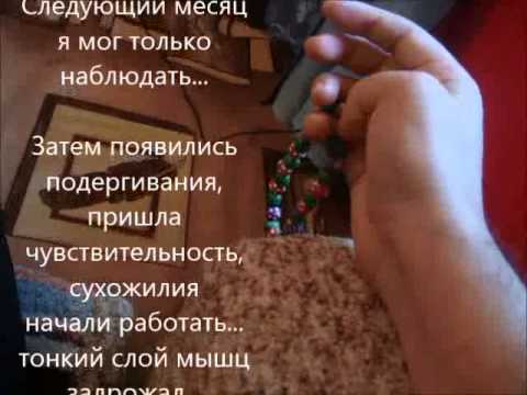 Упражнение на укрепление грудного отдела позвоночника Тянущие боли в левом боку со спины
