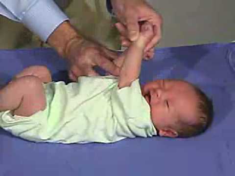 physical exam -Newborn Normal: Tone - Scarf Sign