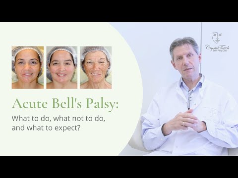 Acute Bell's palsy: What to do, What NOT to do and What to expect