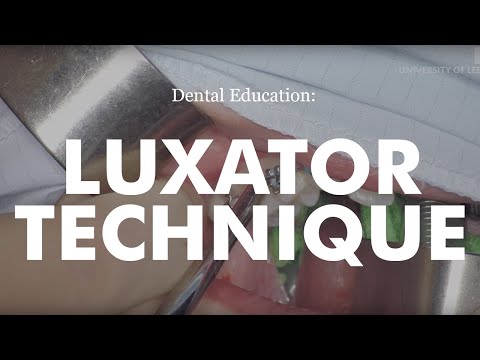 Demonstration of Luxator Technique for Dental Extraction