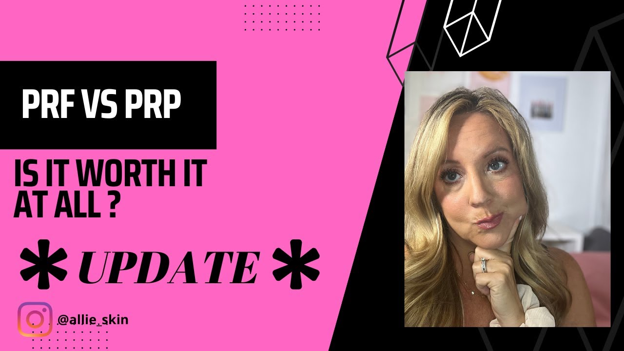 PRF vs PRP | UPDATE: Where are we now?