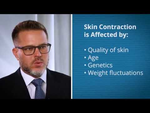 ¿Cómo funciona el contorno corporal?