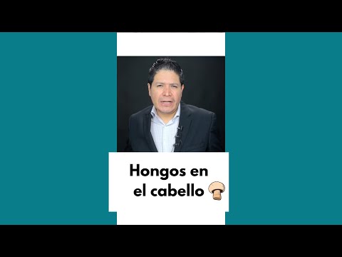 ¿Hongos en el cuero cabelludo?