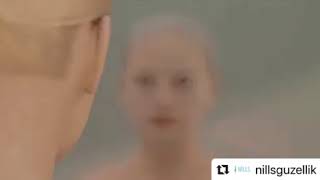 Yüksek oranda hyalüronik asit