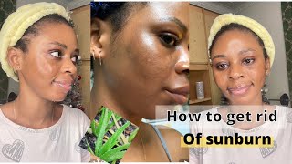 How to get rid of SUNBURN fast on the face/ simply and effective natural home remedy!